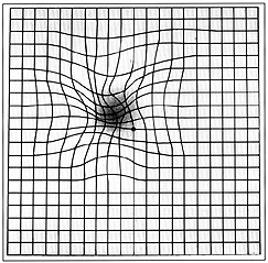 The-Amsler-Grid